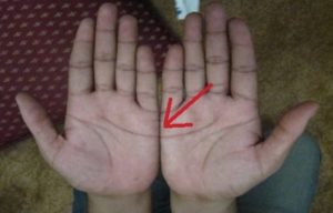 terapi palmistry